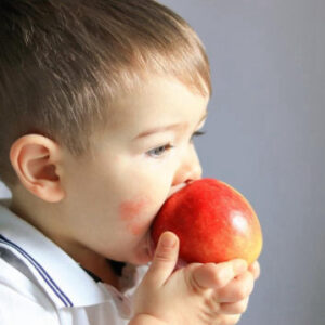 uzmanlar besin alerjisine karsi alinmasi gereken onlemleri acikladi agJ2hymG