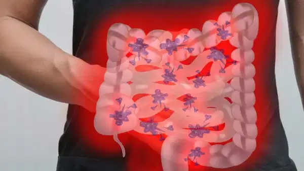 tatil donusu bagirsak sagligina dikkat edilmeli rrXn3TRJ