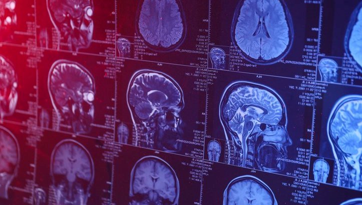 insan beyninin en verimli oldugu yas belli oldu UJ6OWCTi.jpg